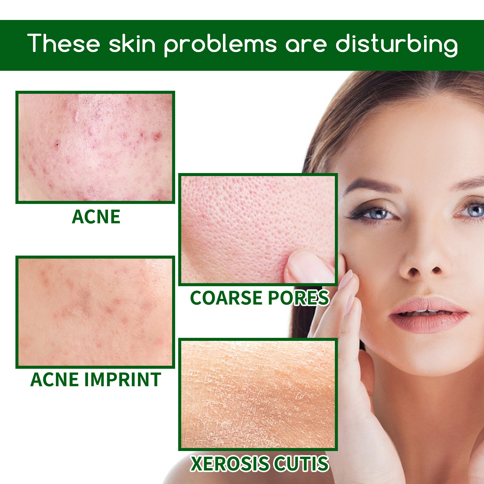 Salicylic Acid Anti Acn-e Face - đánh giá và giá Skincare Salicylic Acid