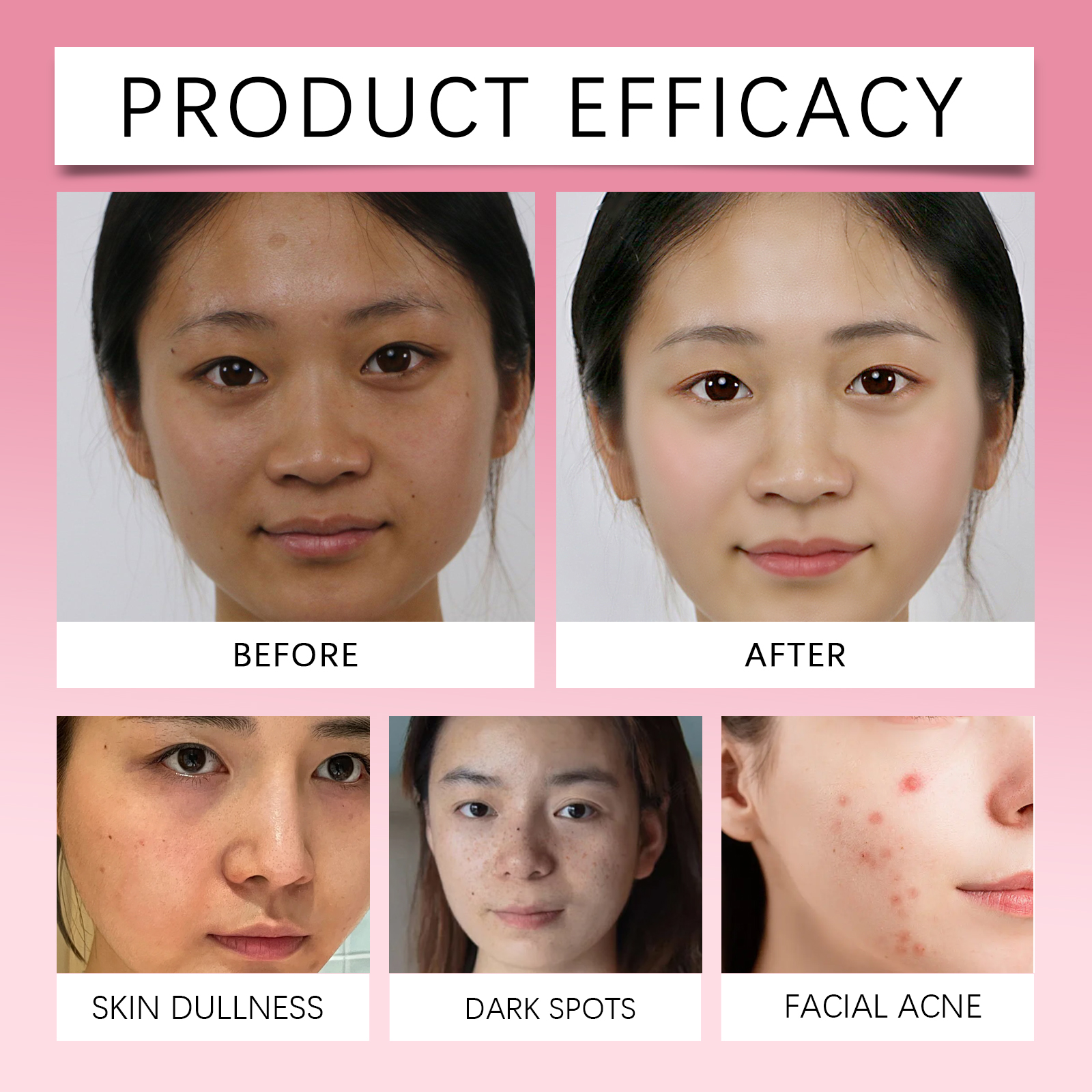 Kojic Acid Turmeric Facial Pad - đánh giá và giá Kojic Acid Soap