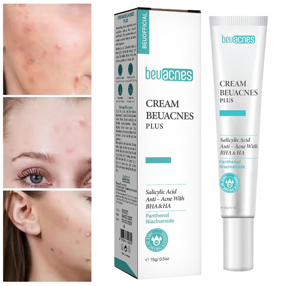 New 20g Niacinamide Acne Gel A - đánh giá và giá Skincare Salicylic Acid