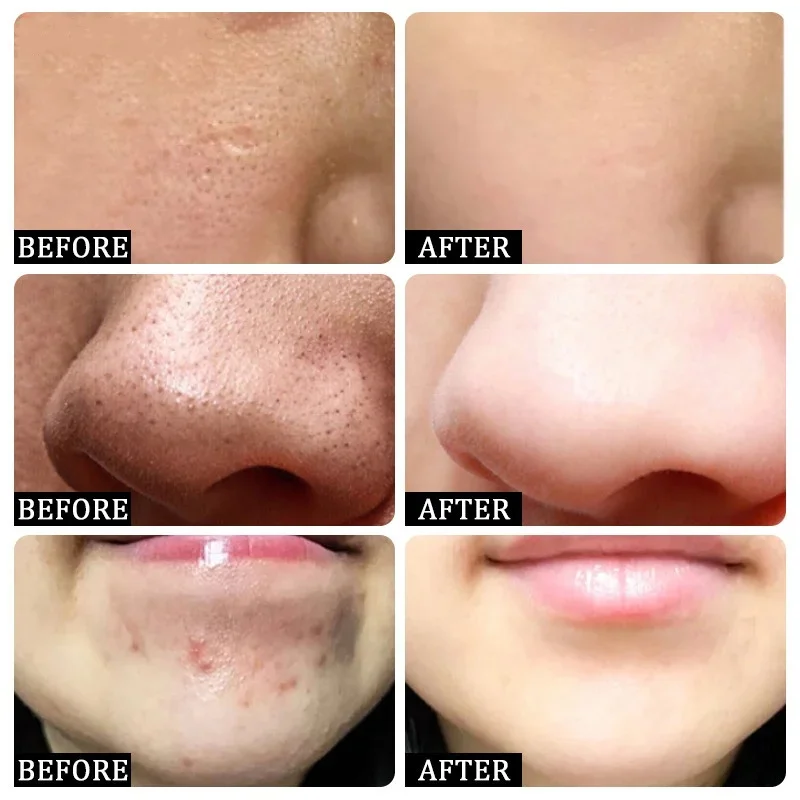 Salicylic Acid Pore Clearing C - đánh giá và giá Skincare Salicylic Acid