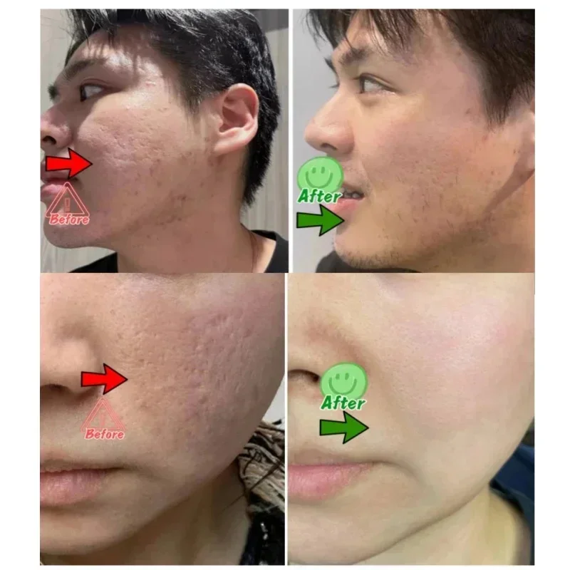 Salicylic Acid Pore Clearing C - đánh giá và giá Skincare Salicylic Acid