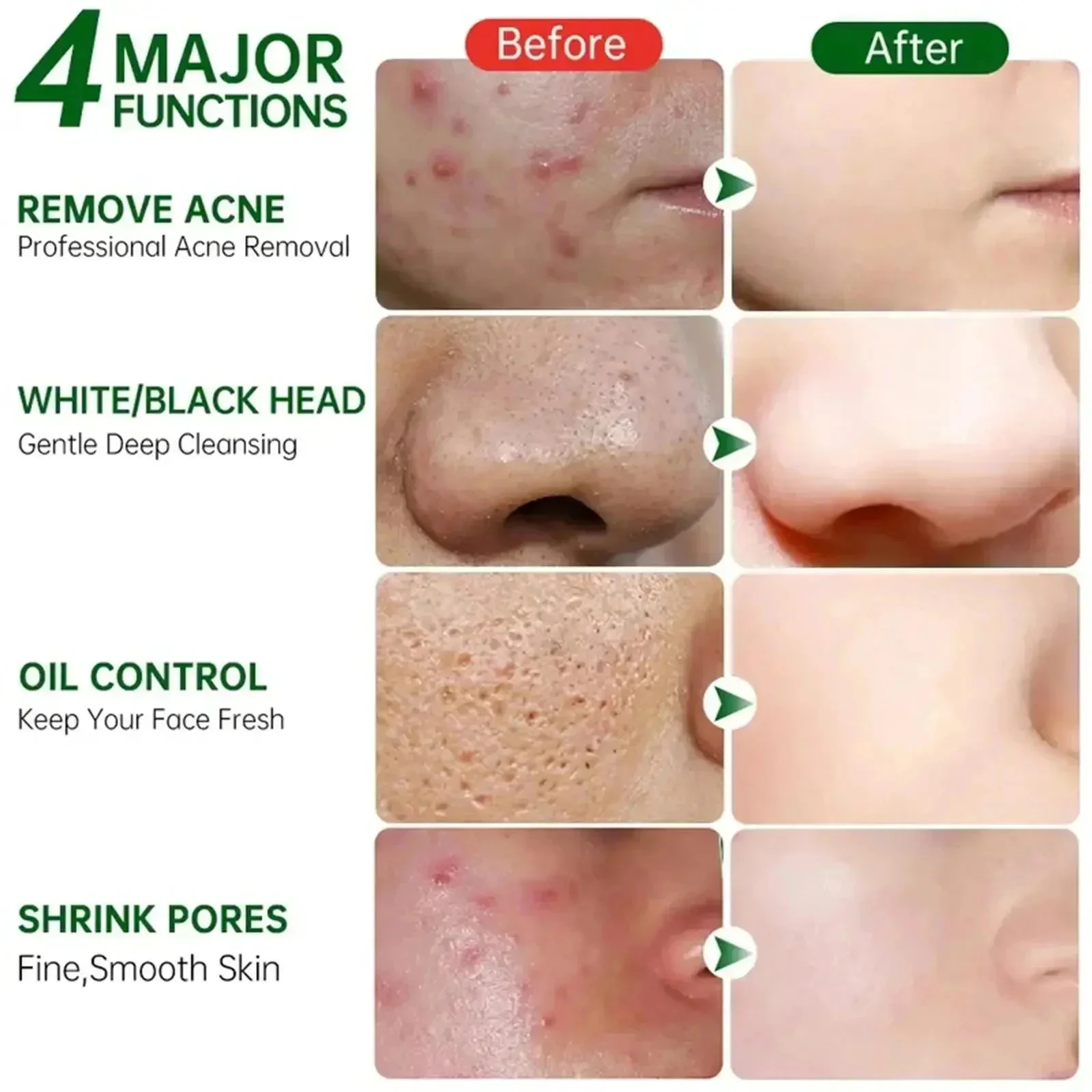 Salicylic Acid Pore Clearing C - đánh giá và giá Skincare Salicylic Acid