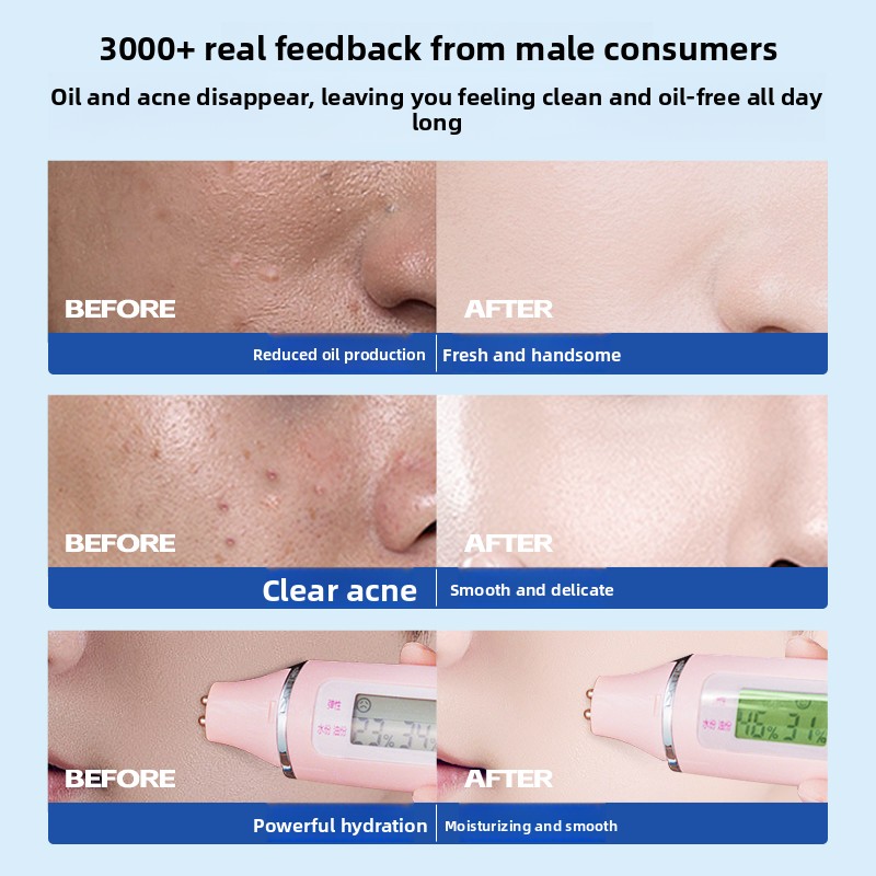 RUYI Men Skin Care Set Salicyl - đánh giá và giá Skincare Salicylic Acid