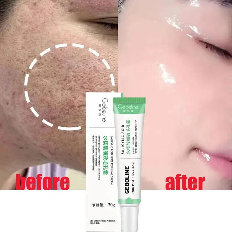 Salicylic Acid Pore Shrinking  - đánh giá và giá Skincare Salicylic Acid