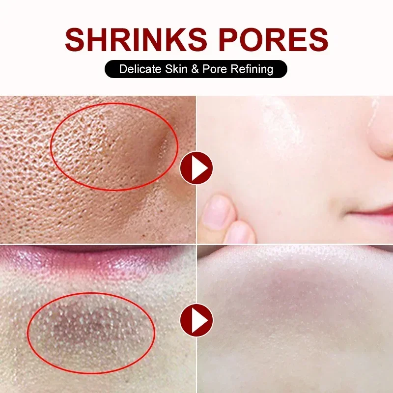 Salicylic Acid Pore Shrinking  - đánh giá và giá Skincare Salicylic Acid