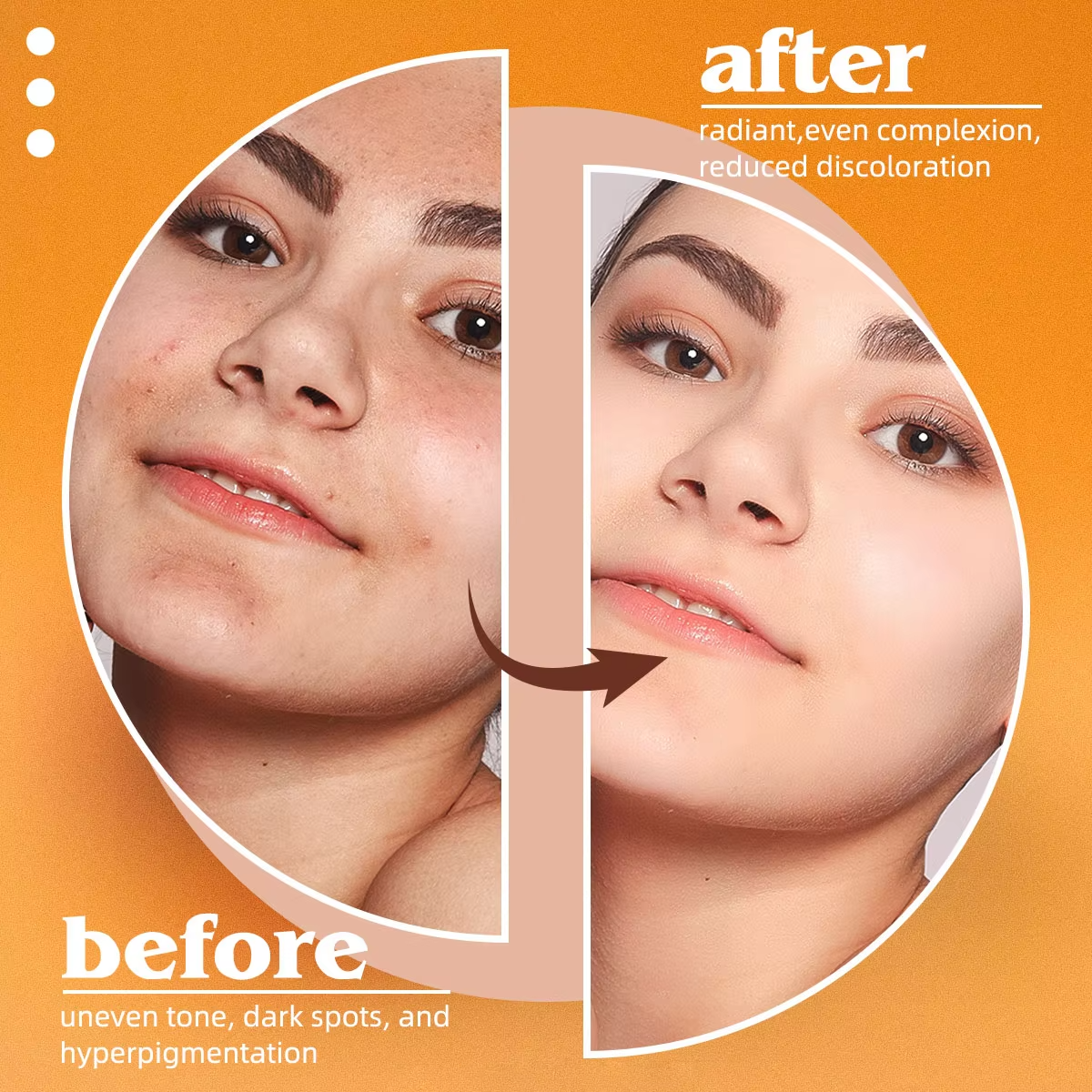 Kojic Acid Natural Papaya Soap - đánh giá và giá Kojic Acid Soap