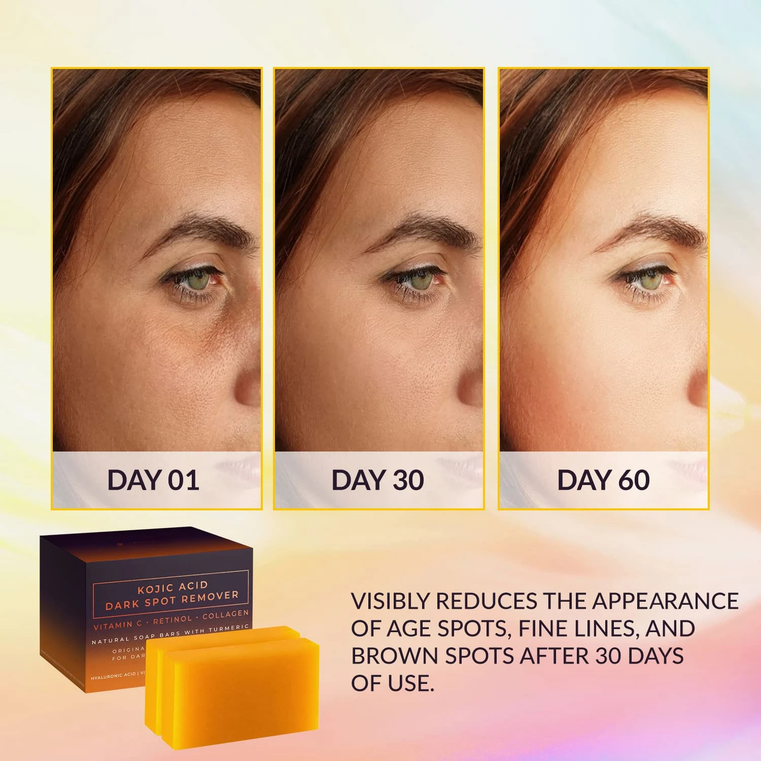 Kojic Acid Dark Spot Remover W - đánh giá và giá Kojic Acid Soap