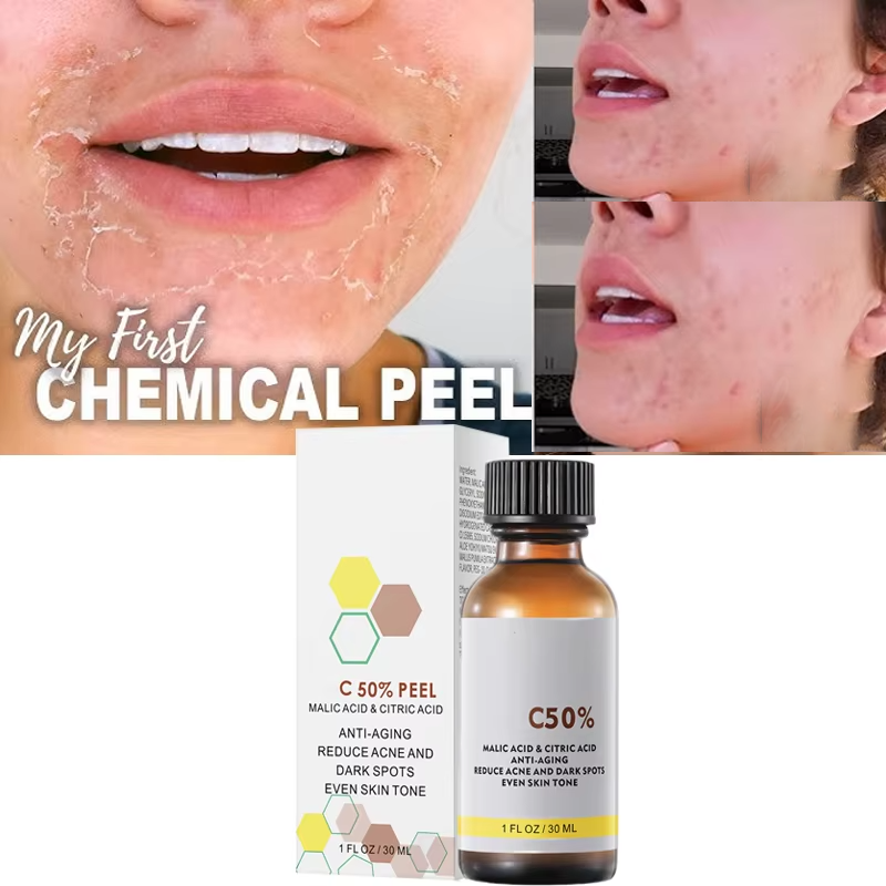 With Malic Acid And Citric Aci - đánh giá và giá Skincare Salicylic Acid