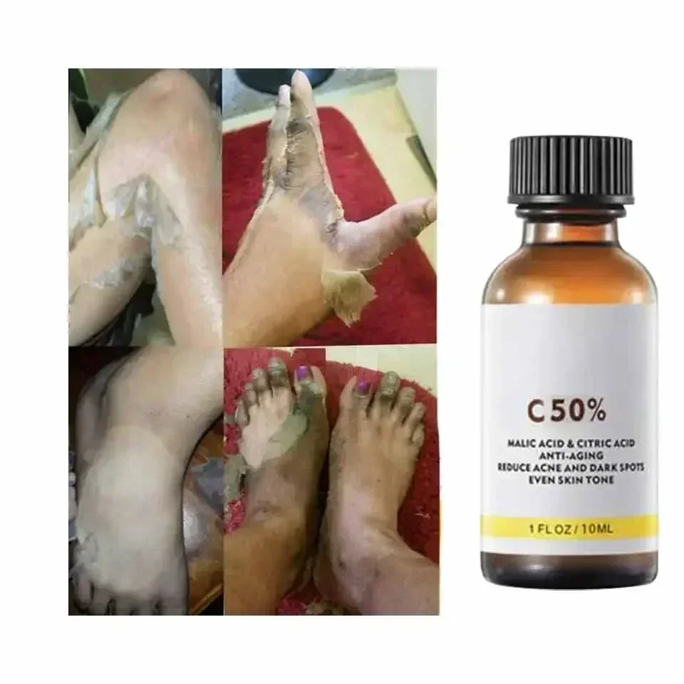 With Malic Acid And Citric Aci - đánh giá và giá Skincare Salicylic Acid