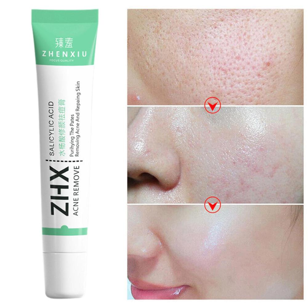 Salicylic Acid Shrink Pore Cre - đánh giá và giá Skincare Salicylic Acid